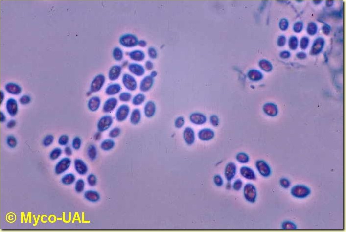 Грибы в мазке. Saccharomyces cerevisiae в мазке. Saccharomyces cerevisiae окраска по Граму. Дрожжей Saccharomyces lactis. Гриб Saccharomyces cerevisiae метиленовым синим.