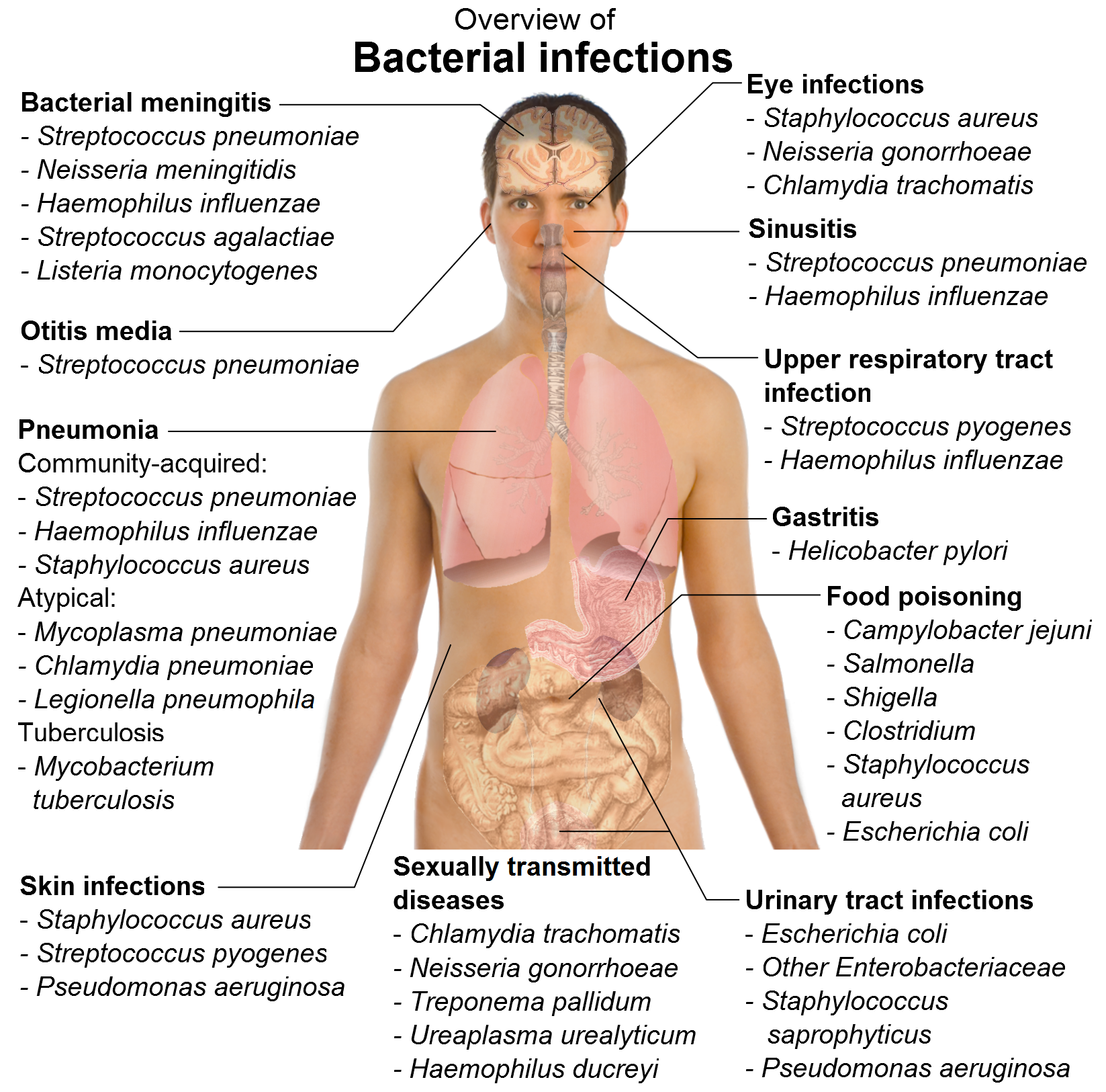 Bacterial infections