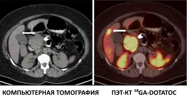 Показывает ли кт