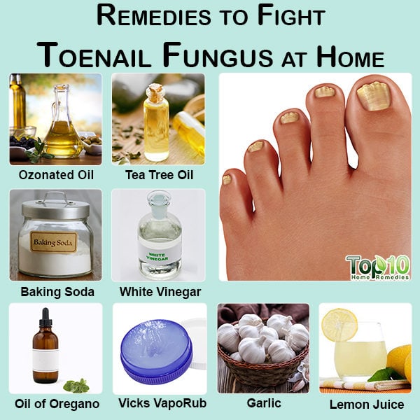 toenail fungus