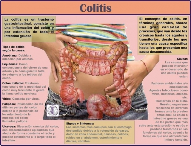 Sintomas colico abdominal